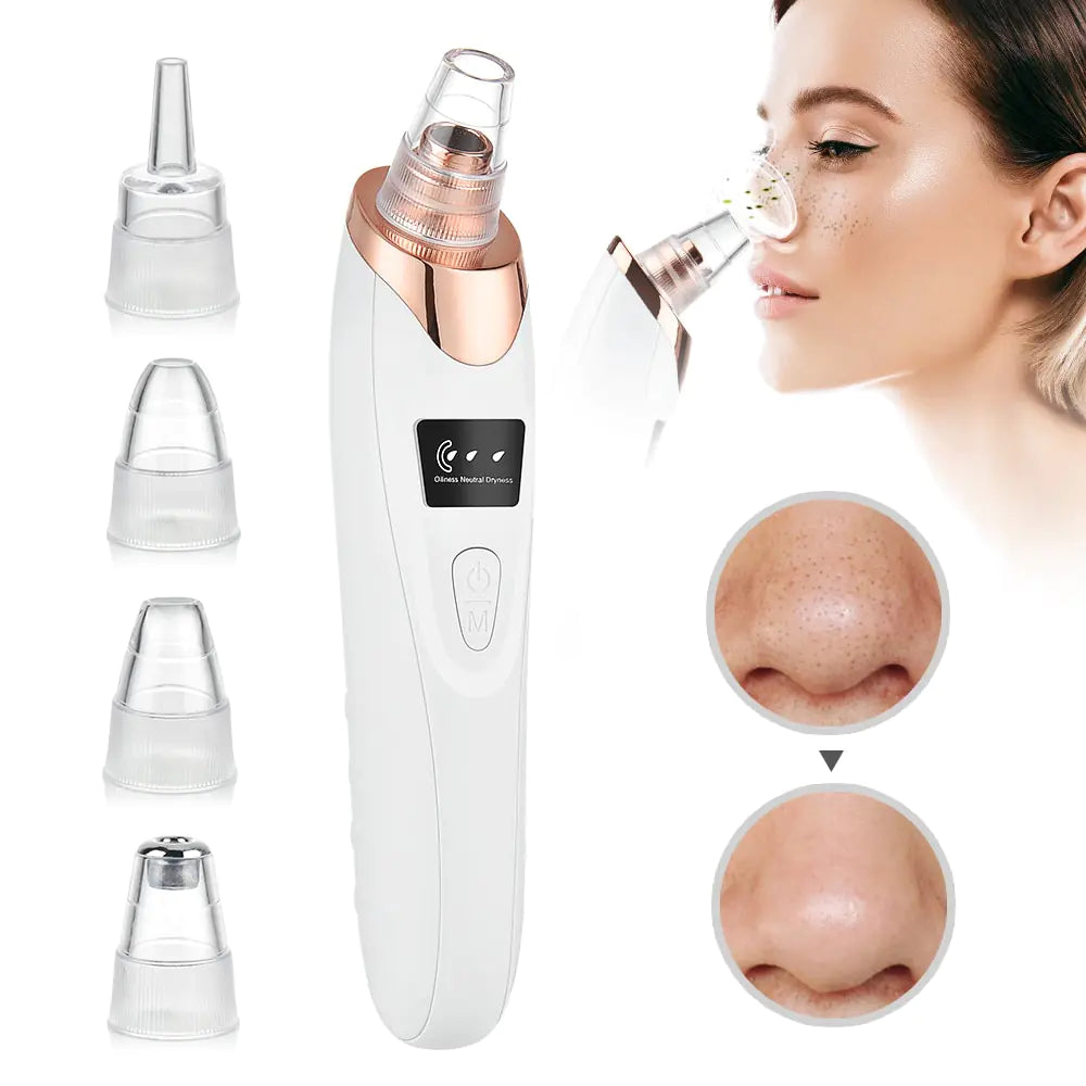 Marcival Hill ClearSkin Pro - Blackhead Remover